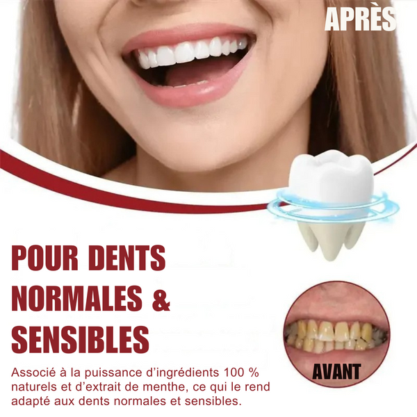 ProBright™ Dents Plus Blanches en 5 Jours