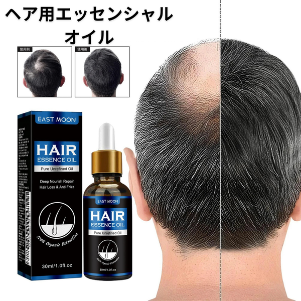 EastMoon ローズマリー ヘアグロースオイル