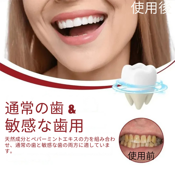 ProBright™ 5日でより白い歯