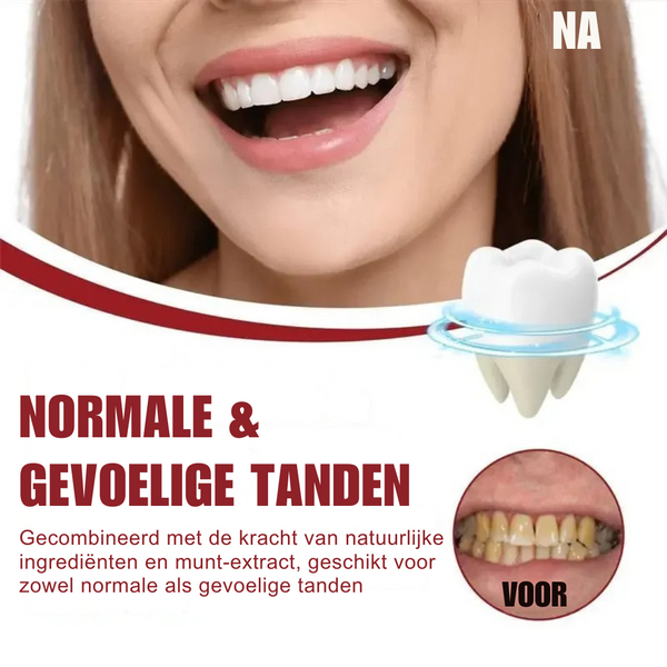 ProBright™ Wittere Tanden in 5 Dagen