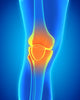 MoveWell™ 2.0 Kniebrace – Ontdek Hoe Duizenden Mensen Hun Kniepijn Natuurlijk Verlichtten