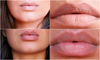 LipBoost™ – Natuurlijke lipverzorging zonder injecties of dure behandelingen