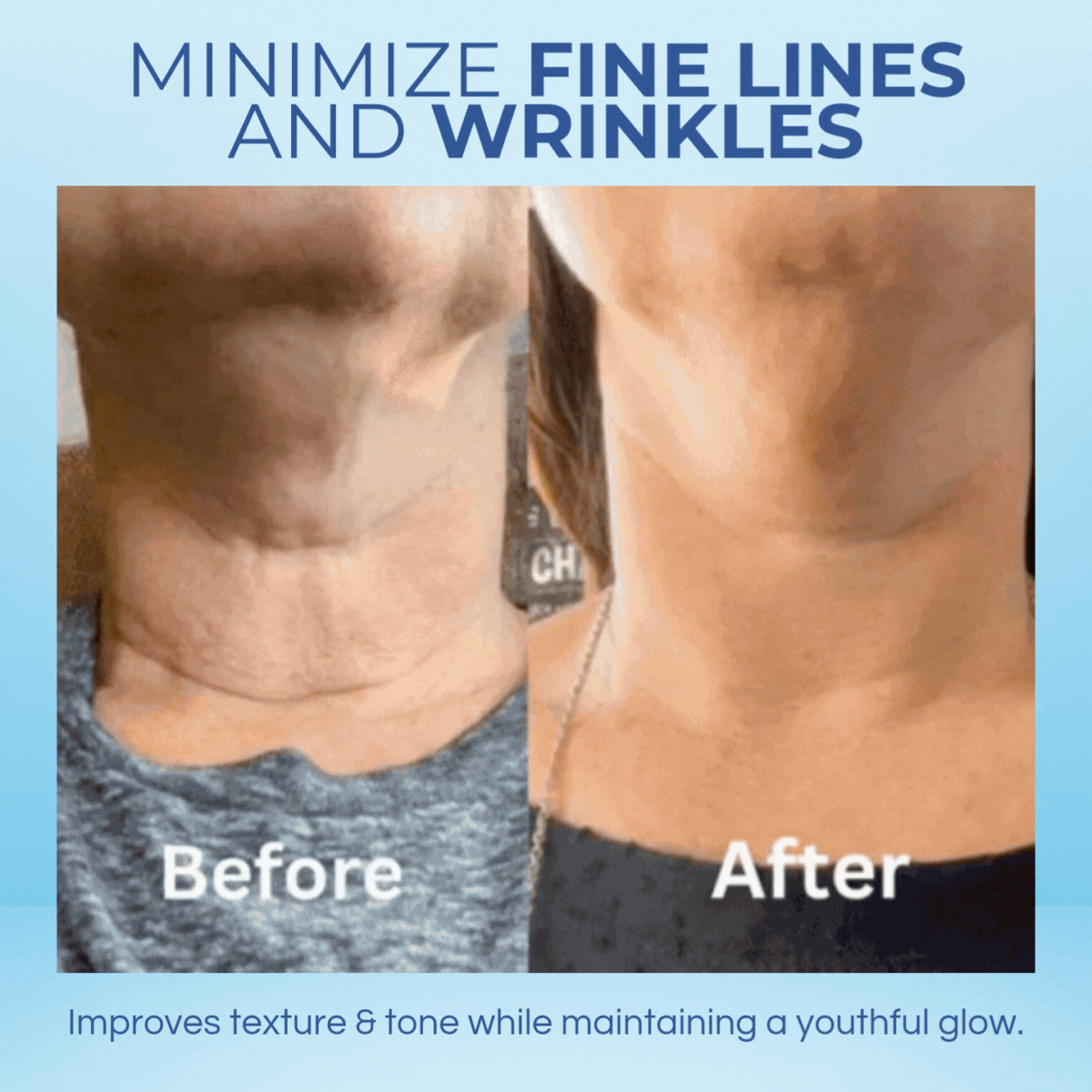 Hoygi Skin Revive & Firming Cream | Direkte forstærkning, løft & foryngelse