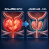 ProstaCalm™ | Clinically Proven to Shrink Your Prostate 53% — Feel It in 5 Days