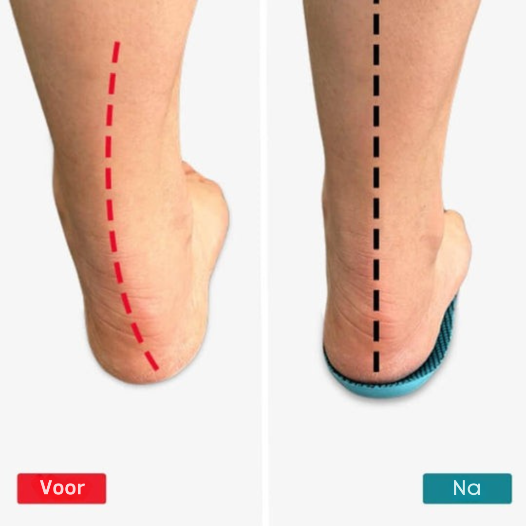 SootheSteps – Erleben Sie schmerzfreie Tage ohne teure Behandlungen oder Arztbesuche... 