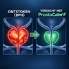 ProstaCalm™ | Endlich Linderung bei Prostatabeschwerden, ohne den Preis, den Sie für Tamsulosin bezahlt haben