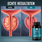 Prostatakompleks | Genopret urinvejskontrol og selvtillid — dokumenterede resultater efter 30 dage