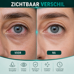 Eye Protection Spray | Restoring Hydration & Comfort — Results from Day One