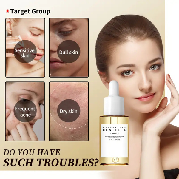 Centella™ Soothes Pimples. Hydrate Without Worries.