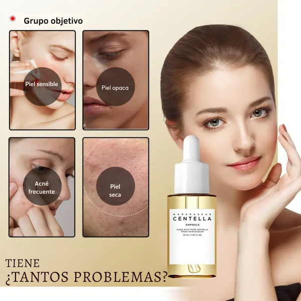 Centella™ Suaviza los granos. Hidrata sin preocupaciones.