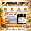 Relieve Skin | Red Skin and Irritation in 7 Days — Clinically Proven & Natural