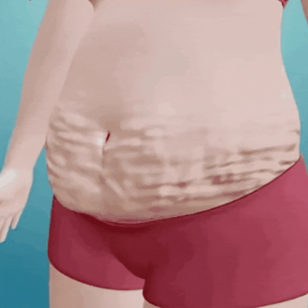 Parches Vagox™ para Control de la Vejiga