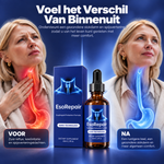 EsoRepair | Sana tu esófago y recupera el bienestar digestivo en 7 días — Potenciado con nanotecnología y de eficacia natural comprobada