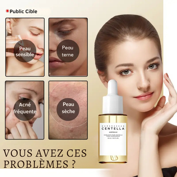 Centella™ Apaise les boutons. Hydrate sans souci.