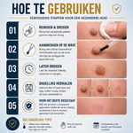 Wart Remover | Powerful liquid for stubborn warts — Works quickly for targeted wart care