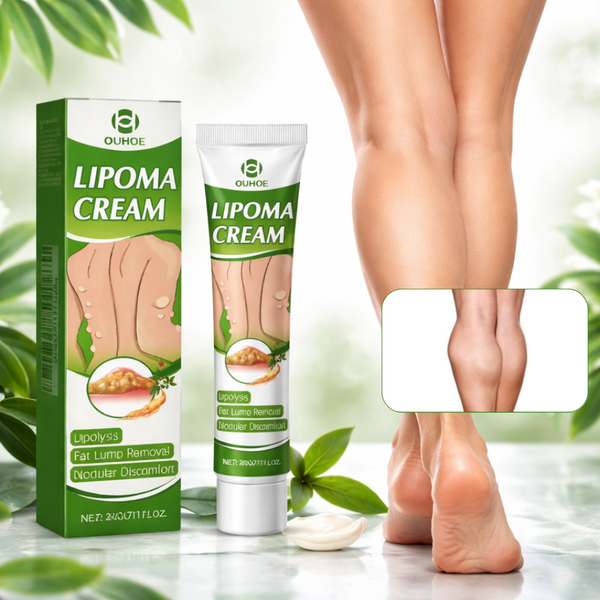 Lipoma Conqueror Cream Quick Solution