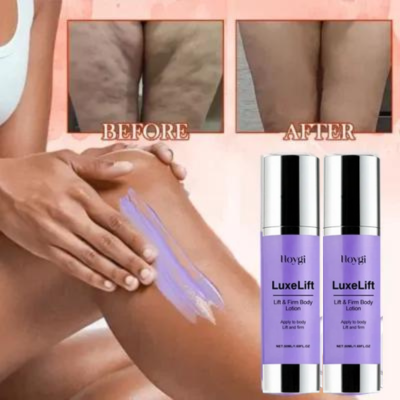 Hoygi LuxeLift | Sollevare e rassodare come mai prima d'ora!