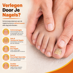 Nährendes Bienengift Nagelspray | Kraft & Glanz Wiederherstellen — Sichtbar Gesündere Nägel in 7 Tagen
