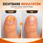 Nährendes Bienengift Nagelspray | Kraft & Glanz Wiederherstellen — Sichtbar Gesündere Nägel in 7 Tagen