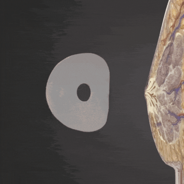 OceAura Chest Support Patch