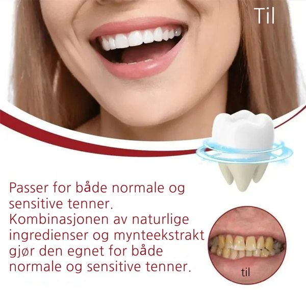 ProBright™ Lysere tenner på 5 dager
