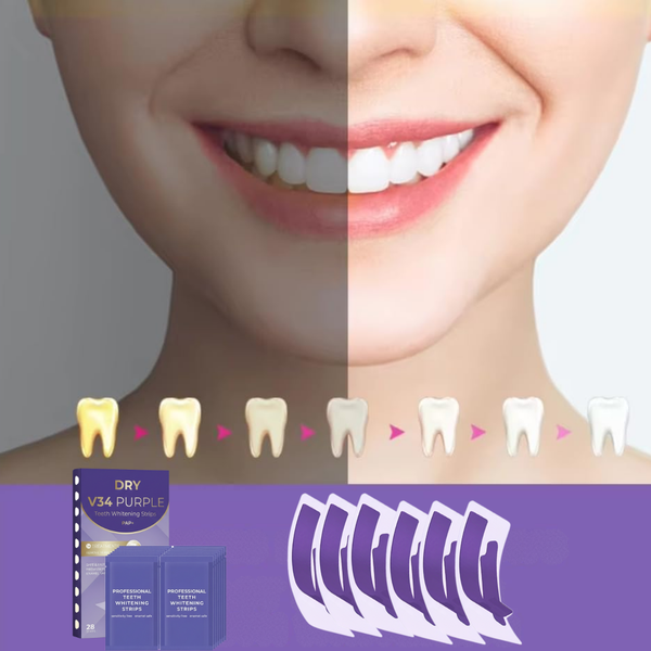 VividWit V34 Leende Remsor