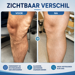 Varicose Relief Spray | Fades Visible Veins & Soothes Heavy Legs — Results You Can See in Weeks
