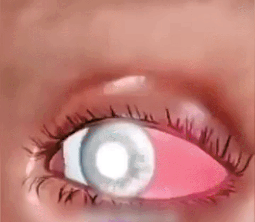 Medilisk Ögonvårdsrulle