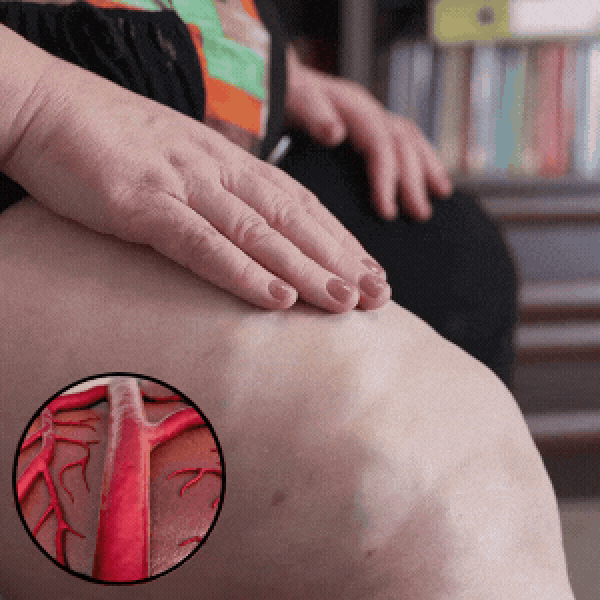 OceAura Varicose Crème