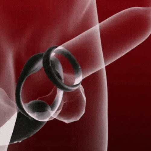 VibeX Pro Anaal Ring
