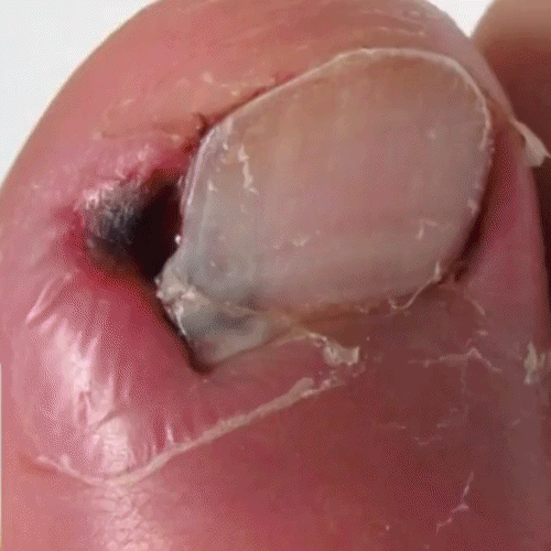 Spray Venijn NailGuard