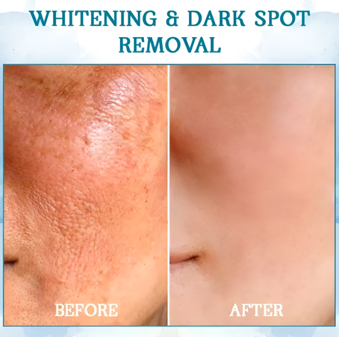 Ouhoe™ Crema Rassodante e Ringiovanente | Bellezza senza tempo