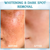 Ouhoe™ Crema Rassodante e Ringiovanente | Bellezza senza tempo
