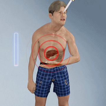 LiverHerstel Kruidendruppels