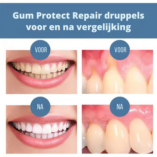 Caviclear™ | Verzacht Tandvleespijn, Ontdek een Wittere Glimlach - PharmaXtra