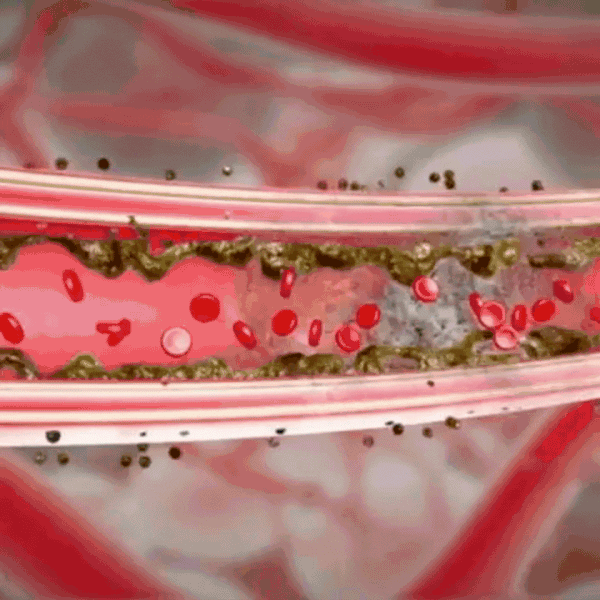 IntimaPure™  Een intieme crème die bacteriën bestrijdt en jeuk onmiddellijk verlicht!