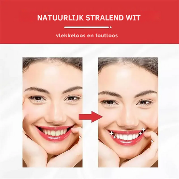 ProBright™ | Wittere Tanden in 5 Dagen - PharmaXtra