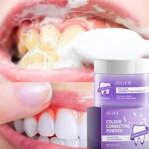 PureDent™ Denti Più Bianchi e Freschi in Soli 5 Giorni