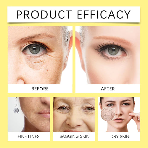 VitaFirm™ Verwijder rimpels, geef je zelfvertrouwen een boost! - PharmaXtra