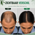 Rosemary Hydrolyzed Keratin Shampoo | Restore Hair Strength — Results in 4 Weeks