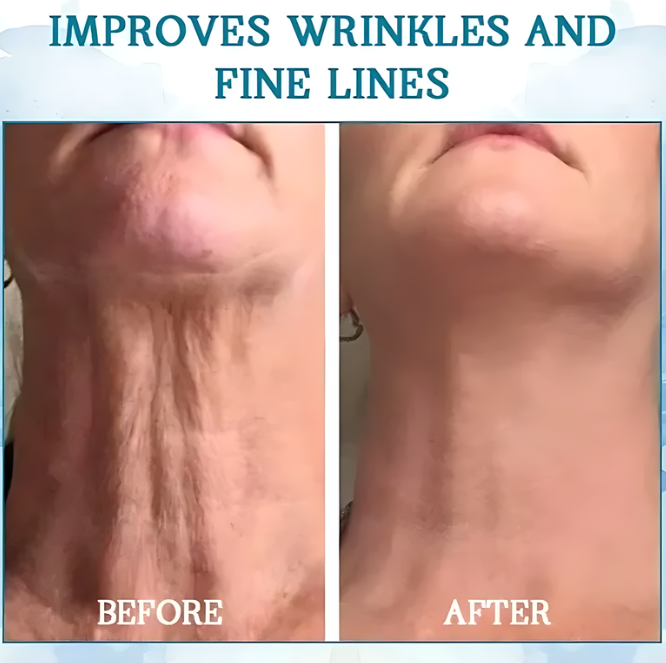 Ouhoe™ Crema Rassodante e Ringiovanente | Bellezza senza tempo